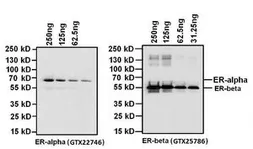 Anti-Estrogen Receptor alpha antibody [33] used in Western Blot (WB). GTX22746