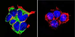 Anti-Mineralocorticoid Receptor antibody [H10E4C9F] used in Immunocytochemistry/ Immunofluorescence (ICC/IF). GTX22774