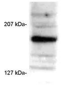 Anti-SRC3 antibody [AX15.3] used in Western Blot (WB). GTX22782