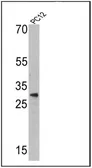 Anti-Endothelin 1 antibody [TR.ET.48.5] used in Western Blot (WB). GTX22786