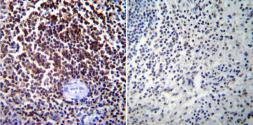 Anti-NFAT2 antibody [7A6] used in IHC (Paraffin sections) (IHC-P). GTX22796
