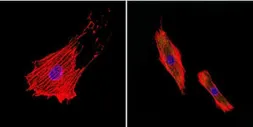 Anti-pan NOS antibody [NOS-3F7-B11 B5] used in Immunocytochemistry/ Immunofluorescence (ICC/IF). GTX22801