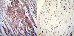 Anti-SERCA1 ATPase antibody [VE121G9] used in IHC (Paraffin sections) (IHC-P). GTX22819