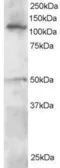 Anti-HLTF antibody used in Western Blot (WB). GTX22835