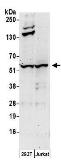 Anti-Chk1 antibody used in Western Blot (WB). GTX22845