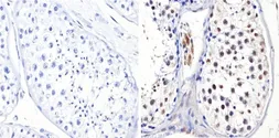 Anti-DNMT3B antibody used in IHC (Paraffin sections) (IHC-P). GTX22851