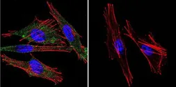 Anti-Calmodulin antibody [2D1] used in Immunocytochemistry/ Immunofluorescence (ICC/IF). GTX22860