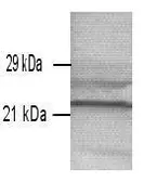 Anti-Prion Protein (PrP) antibody [1E5 / G6] used in Western Blot (WB). GTX22879
