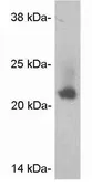 Anti-Caveolin 2 antibody used in Western Blot (WB). GTX22911
