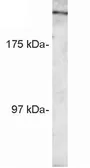 Anti-RANBP2 antibody used in Western Blot (WB). GTX22938