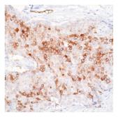 Anti-RPSA antibody [MLuC5] used in IHC (Paraffin sections) (IHC-P). GTX23099