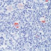 Anti-Bcl-X antibody [2H12] used in IHC (Paraffin sections) (IHC-P). GTX23193