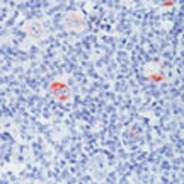 Anti-Bcl-X antibody [2H12] used in IHC (Paraffin sections) (IHC-P). GTX23193
