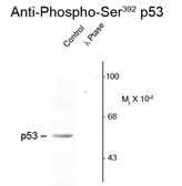 Anti-p53 (phospho Ser392) antibody used in Western Blot (WB). GTX23257