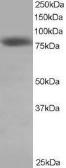 Anti-Hec1 antibody, C-term used in Western Blot (WB). GTX23393