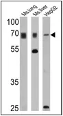 Anti-PMP70 antibody used in Western Blot (WB). GTX23421