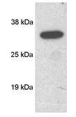 Anti-SCAMP 1 antibody used in Western Blot (WB). GTX23430
