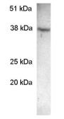 Anti-SCAMP2 antibody used in Western Blot (WB). GTX23431