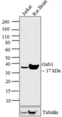 Anti-GNB1 antibody used in Western Blot (WB). GTX23433