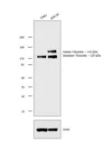 Anti-Nicastrin antibody used in Western Blot (WB). GTX23444