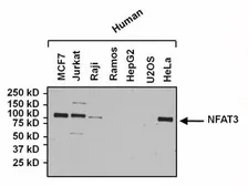 Anti-NFATC4 antibody used in Western Blot (WB). GTX23447