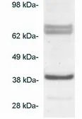 Anti-BLVRA antibody used in Western Blot (WB). GTX23466