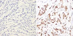 Anti-NCOR1 antibody used in IHC (Paraffin sections) (IHC-P). GTX23482