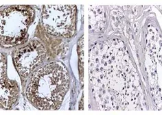 Anti-DNMT3L antibody used in Immunohistochemistry (IHC). GTX23493