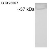 Anti-Cyclophilin 40 antibody used in Western Blot (WB). GTX23567