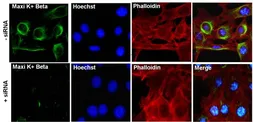 Anti-KCNMB1 antibody used in Immunocytochemistry/ Immunofluorescence (ICC/IF). GTX23587