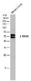 Anti-RAGE antibody used in Western Blot (WB). GTX23611