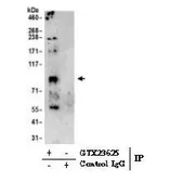 Anti-SERCA2 ATPase antibody used in Immunoprecipitation (IP). GTX23625
