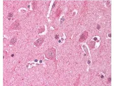 Anti-LDB2 antibody used in IHC (Paraffin sections) (IHC-P). GTX23627