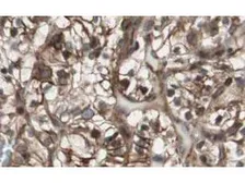 Anti-MAD2L2 antibody used in IHC (Paraffin sections) (IHC-P). GTX23630