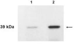 Anti-Kallikrein 4 antibody used in Western Blot (WB). GTX23636