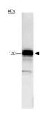 Anti-FANCJ antibody [pp15-IB4] used in Western Blot (WB). GTX23641