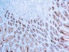 Anti-Mucin 5AC antibody [45M1] used in IHC (Paraffin sections) (IHC-P). GTX23649