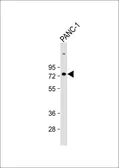 Anti-SENP1 antibody used in Western Blot (WB). GTX23656
