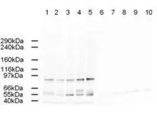 Anti-Ap2A antibody used in Western Blot (WB). GTX23707