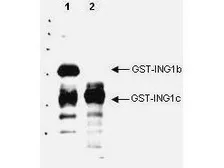Anti-ING1 antibody used in Western Blot (WB). GTX23711