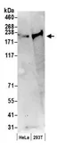 Anti-Claspin antibody used in Western Blot (WB). GTX23719