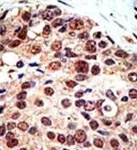 Anti-PRMT3 antibody used in IHC (Paraffin sections) (IHC-P). GTX23765