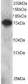 Anti-SETMAR antibody used in Western Blot (WB). GTX23823
