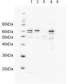 Anti-RAD23A antibody used in Western Blot (WB). GTX23836