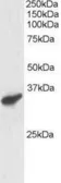 Anti-RNF3 antibody used in Western Blot (WB). GTX23892