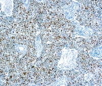 Anti-Cyclin E antibody [HE12] used in IHC (Paraffin sections) (IHC-P). GTX23927