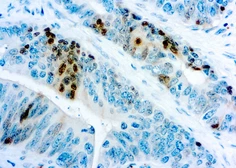Anti-p27 Kip1 antibody [DCS-72.F6] used in IHC (Paraffin sections) (IHC-P). GTX23928