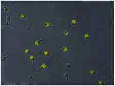 Anti-VCP antibody [Hs-14] used in Immunocytochemistry/ Immunofluorescence (ICC/IF). GTX23983