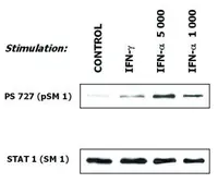 Anti-STAT1 antibody [SM1] used in Western Blot (WB). GTX23987
