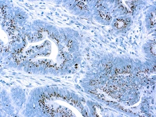 Anti-Caspase 3 antibody used in IHC (Paraffin sections) (IHC-P). GTX24051